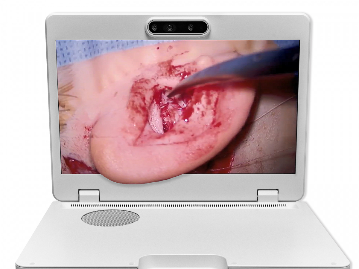 达擎之＂Heads-up 3D显微手术显示系统＂，整合4K裸眼3D显示及眼球追踪系统，具备快速追踪人眼移动位置功能，减轻医师长时间维持固定姿势的负担，让医师能有更宽广清晰的3D立体视野及更舒适的姿势来执行手术。